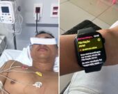 Relógio inteligente salva vida de personal trainer de Palmas com alerta de fibrilação atrial 